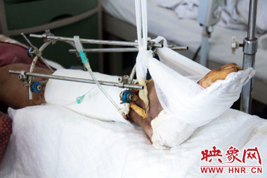新乡危重男孩无力支付高额医药费 欲免费打工3年