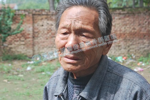 郑州仁济医院组织专家 下乡为小凤献复查