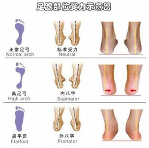 高弓足的病因