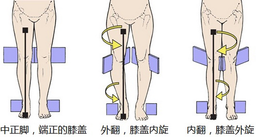 膝外翻不影响功能可以不治疗吗