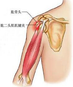 ôƺ