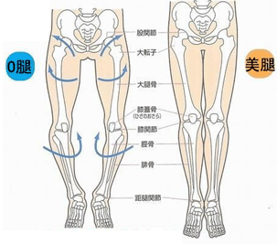 膝内翻什么时候治疗效果较好